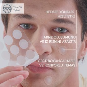 Resim Microneedle Teknolojili Akne Patch, Sivilce Karşıtı Yama, Mikroiğneli Akne Bandı, 9 Adet 