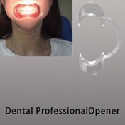 Resim Diş Beyazlatma için Ağız Bakımı Açıcı Genişletici, C-Tipi Güzellik Diş Desteği, Lezzetsiz, Ağız Hijyeni için Kullanımı Kolay 