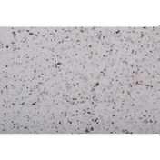 Resim Orjinal Canlı Sıva (166051829) 