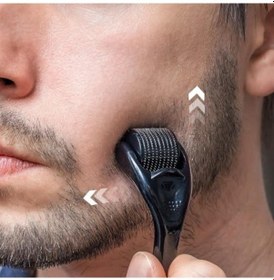 Resim Derma Rulo 1.0mm, 540 Titanyum Microneedle Rulo Yüz Yüz Kırışıklıkları İçin Saç Dökülmesi Streç İşaretleri Saç Büyütme Mikro İğneler Profesyonel Microneedling Derma İğneleme Kiti Kılıf İle 0 