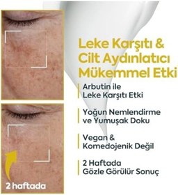 Resim Leke Karşıtı Aydınlatıcı Yüz İçin Koyu Leke Giderici, Siyah Nokta Karşıtı Cilt Bakım Kremi, Komedojenik Olmayan Hafif Nemlendirici, 40 Ml 4 Paketi Açık Altın 