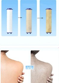 Resim Mintev Filtreli Arıtmalı Masajlı Çok Fonksiyonlu Krom Beyaz Elit Duş Başlığı Beyaz 