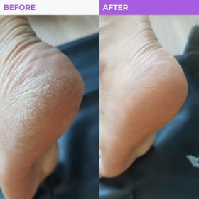 Resim Baren - Callus Remover Double Sided Foot File (Çift Taraflı Pro Ayak Törpüsü) 