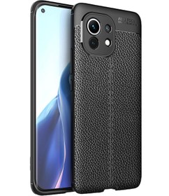 Resim Microcase Xiaomi Mi 11 Lite Leather Tpu Silikon Kılıf - Siyah 