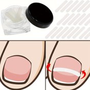 Resim Kutulu tırnak bakım seti ve yamalar, ayak parmakları için uygun. İçe doğru uzayan tırnaklar için ayağınızı koruma ve tırnak yerleştirme araçları. Tırnak bakımı, hediye 