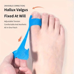 Resim 12 Adet Tıbbi Dereceli Kinesiyoloji Band Hallux Valgus Düzeltici - Ayarlanabilir Gerilim, Spor Yaralanma Önleme & Ayak Konforu Desteği için Su Geçirmez Büyük Parmak Doğrultucu, Tek Yama Uygulama Tasarımı, Ayak Ağrısı Korreksiyonu, Dayanıklı Ayak Bakımı, Rahat Kullanım, Nefes Alabilen Malzeme, Aktif Yaşam Tarzı 