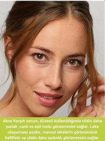 Resim Siyah Nokta, Sivilce Ve Akne Karşıtı, Gözenek Sıklaştırıcı Cilt Serumu Pelargonium Niacinamide Hyaluronic Acid Panthenol 30 Ml 