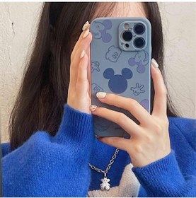 Resim Mobildizayn Samsung A7 2018 Desenli Lansman Kılıf 