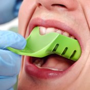 Resim 10'lu Diş İzleme Trays Seti, Üniversal Polipropilen Diş Traysı, Laboratuvar Ekipmanı ve Diş Öğrencileri için Düz Kenar Tasarım 