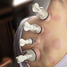 Resim Yüksek Emişli El Kuvvetli Kaplama Cihazı - Tam Vücut Masajı İçin Dayanıklı Plastik, Pil Gerektirmez, Fiyat Anormal, Ev Kullanımı İçin İdeal 