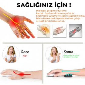 Resim Microcase Ortopedik Mouse Bilek Destek - Kaydırmaz Taban Ergonomik Mouse Önü Bilek Destek Pedi - Al5373 Siyah 