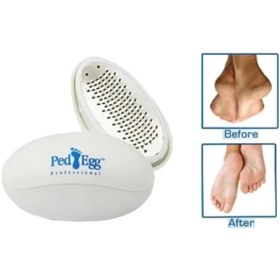 Resim K-Yonlineticaret Ped Egg Topuk Törpüsü 