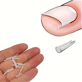 Resim 10/20/30 Adet Batık Tırnak Düzeltici Pedler, İçe Doğru Büyüme için Tırnak Düzeltme Araçları, Batık Tırnak Yastıkları ve Dolgu Pedleri, Pedikür Aksesuarları 