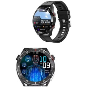 Resim Sw65 Akıllı Saat 