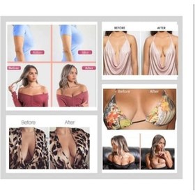 Resim Kindmax Göğüs Sabitleyici Dikleştirici Ve Şekillendirici Bant Siyah Renk 5cmx5m Ramak Grup Ürünü 