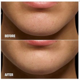 Resim Benefit Cosmetics The Porefessional Degunker - Siyah Nokta Ve Gözenek Arındırıcı Sistem 
