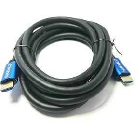 Resim Hiremco 4K 60Hz Ultra Hd 5Metre Hdmi Kablo V2.0 