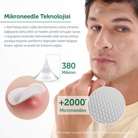 Resim Microneedle Teknolojili Akne Patch, Sivilce Karşıtı Yama, Mikroiğneli Akne Bandı, 9 Adet 