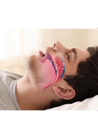 Resim Rahat Uyku İçin Anti Snore Sleep Horlama Engelleyici Aparat Uyku Stoperi 