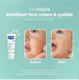 Resim Stelatopia Emollient Yüz Kremi 40ml 