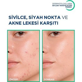 Resim Bioderma Sebium Kerato Cover 30 Ml 