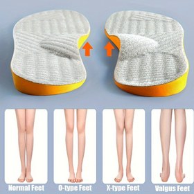 Resim Yetişkinler için 1 Çift O-Tipi Ayak Düzeltici Tabanlık - Ortopedik Şok Emici Nefes Alabilir İçlikler, Ergonomik Tasarım, Sarı Vurgular ve Dokulu Yüzey ile Topuklu, Düz Ayakkabılar, Botlar için - Kamburluğun, Varus/Valgus Ayakların, Normal Ayakların Düzeltilmesi 