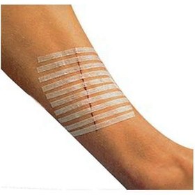 Resim Steri Strip - Steril Yara Bantı 10'lu | 3M 