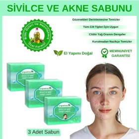 Resim Organicsun Akne ve Sivilce Karşıtı Sabun 3 x 140 G 