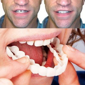 Resim 2 Adet Esnek Beyaz Rahat Ağız Koruyucu, Üst ve Alt Diş Eklentileriyle Unisex Kolay Dental Çözüm - Özgüven Artırıcı, Diş Güveni Yardımcısı,Unisex Diş Çözümü,Esnek Diş Koruyucular,Gizli Ağız Tepsisi,Beyaz Ağız Cihazı,Kolay Temizlenebilir Yüzey,Rahat Kesim Malzeme,Güven Arayanlar,Kullanım Senaryosu/O 