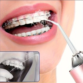 Resim 1 Adet Kablosuz USB Güçlü Elektrikli Su Diş İpi, Taşınabilir Yüksek Basınçlı Ağız Temizleyici - Braketler, Diş Eti Hastalıkları ve Diş Temizliği İçin - Yetişkinler, Gençler ve Yaşlılar için Modern Hediye - Şık Pembe Tasarım, Dayanıklı Akrilik Gövde ile Diş Eti Koruma Cihazı 