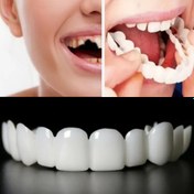 Resim 2 Adet Esnek Beyaz Rahat Ağız Koruyucu, Üst ve Alt Bağlantılı, Unisex Kolay Kullanım Diş Koruma Çözümü, İç Güveni Artırıcı, Özgüven Artırıcı,Ağız Bakım Çözümü,Gizli Koruma,Rahat Kesim,Yüksek Kaliteli Diş Yardımı,Erkekler için Ağız Bakımı 