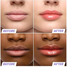 Resim Wonderskin Lip Rehab Nemlendirici Ve Onarıcı Renkli Dudak Serumu Yağı Flirt 3.57ml 