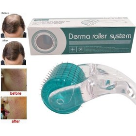 Resim Vkemall Drs Derma Roller 3.0mm Mikroneedle: Yüz Bakımı, Anti-kuruş, Saç Dökümü Tedavisi Ve Tüylü Bıyık Büyümesi İçin Regeneratif Bakım Aleti 