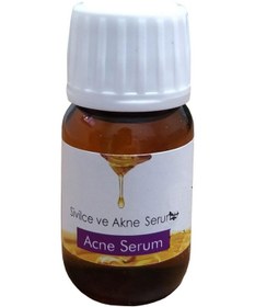 Resim Tabiat Market Sivilce ve Akne Serumu 20 ML 