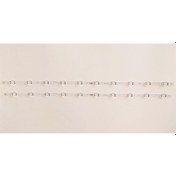 Resim LG 43UF6500 LED Bar Takım Kore Üretimi LG 43 V17 ART3 2867 REV0.3 