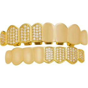 Resim RICH DIAMOND CLASSICO GOLD GRILLZ (Special Order-High Quality) 