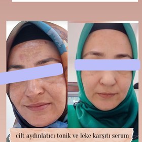 Resim Sabral Leke Karşıtı Aydınlatıcı Set 