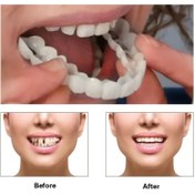 Resim 5 Parça Set: 1 Üst Protez + 1 Alt Protez + 2 Yapışkan Bant + 1 Kutu – Erkekler, Kadınlar ve Gençler İçin Ayarlanabilir Takma Dişler – Rahat, Doğal Görünüm, Kolay Temizlenebilir, Cerrahi Gerektirmez 