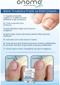 Resim Health Batık Tırnak Düzeltici Şerit 10 Adet 