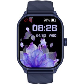 Resim İXTECH Xeefit-10 Akıllı Saat Amoled Ekran Sesli Asistan Konuşma Özellikli 