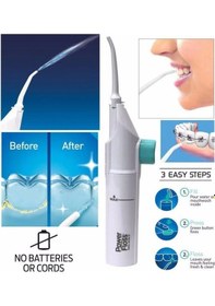 Resim Kulak Temizleme Ve Power Floss Mekanik Diş Ve Ağız Temizleme Aleti Seti Lisinya Standart 