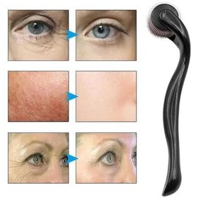 Resim Dermaroller Titanyum 540 Iğneli 1 Mm Saç Kaş Sakal Serum Kullanıma Uygun 