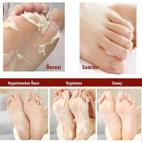 Resim Mjcare Miracle Foot Peeling Pack - Mjcare Çorap Tipi Ayak Peeling Maskesi 