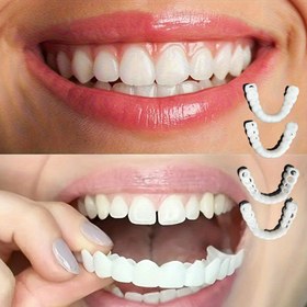 Resim 2 Adet Esnek Beyaz Rahat Diş Koruyucu Üst ve Alt Aksesuarlı, Kolay Giyilen Uniseks Diş Koruma Çözümü ile Artan Özgüven 