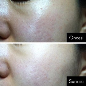 Resim Moremo - Sun Stick SPF50+ PA++++ (Stik UV Güneş Koruyucu Krem) 16g (%25 Tanıtım indirimli) 