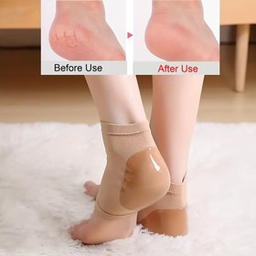 Resim Nemlendirici Topuk Kılıfları, Yumuşatma ve Destek için Silikon Topuk Çorapları, Peeling, Nefes Alabilir, Koku Dirençli - 1 Çift 