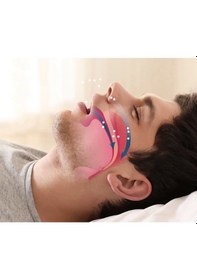 Resim Rahat Uyku İçin Anti Snore Sleep Horlama Engelleyici Aparat Uyku Stoperi Lisinya Standart 