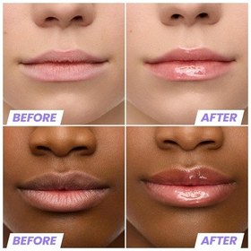 Resim Wonderskin Lip Rehab Nemlendirici Ve Onarıcı Renkli Dudak Serumu Yağı Lover 3.57ml 