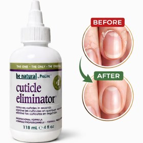 Resim PROLINC Tırnak Eti Giderici 118ml 