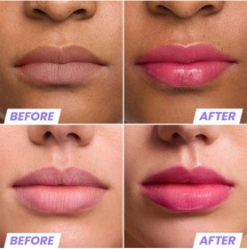 Resim Wonderskin Lip Rehab Nemlendirici Ve Onarıcı Renkli Dudak Serumu Yağı Kissed 3.57ml 